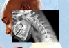 «Cuerpo de teléfono»: cómo la tecnología nos arruga el cuello y debilita las manos