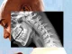 «Cuerpo de teléfono»: cómo la tecnología nos arruga el cuello y debilita las manos